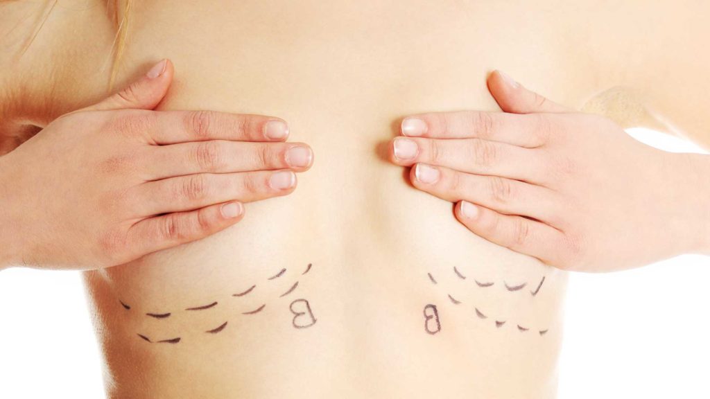 جراحات تجميل الثدي 