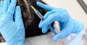 الميزوثيرابي للشعر في تركيا 