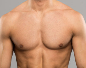 جراحة علاج تثدي الرجال