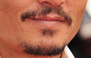 زراعة الشارب في تركيا