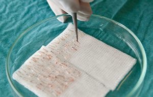 بصيلات الشعر