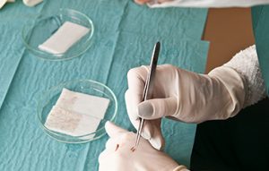 زرع الروابط