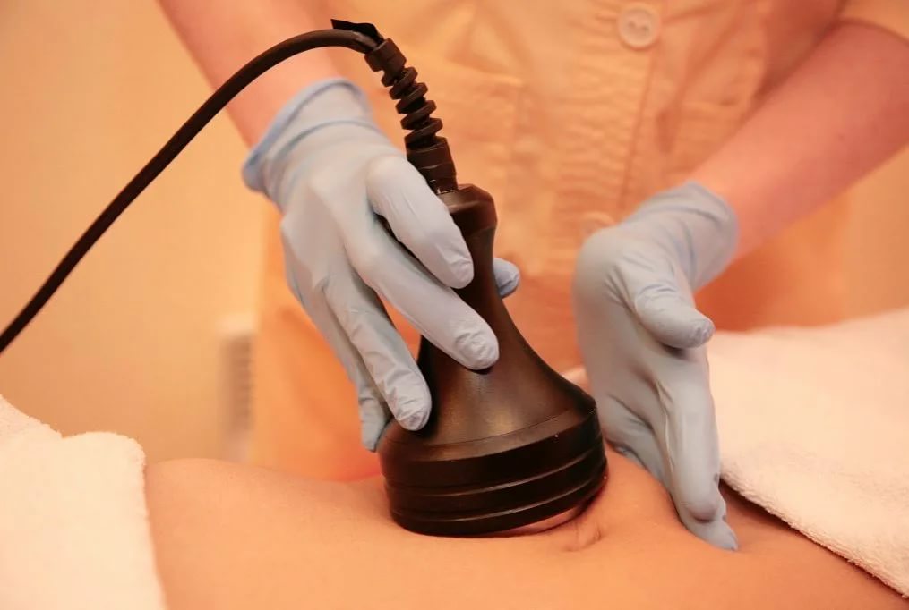  إزالة الكرش