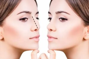 تجميل الأنف