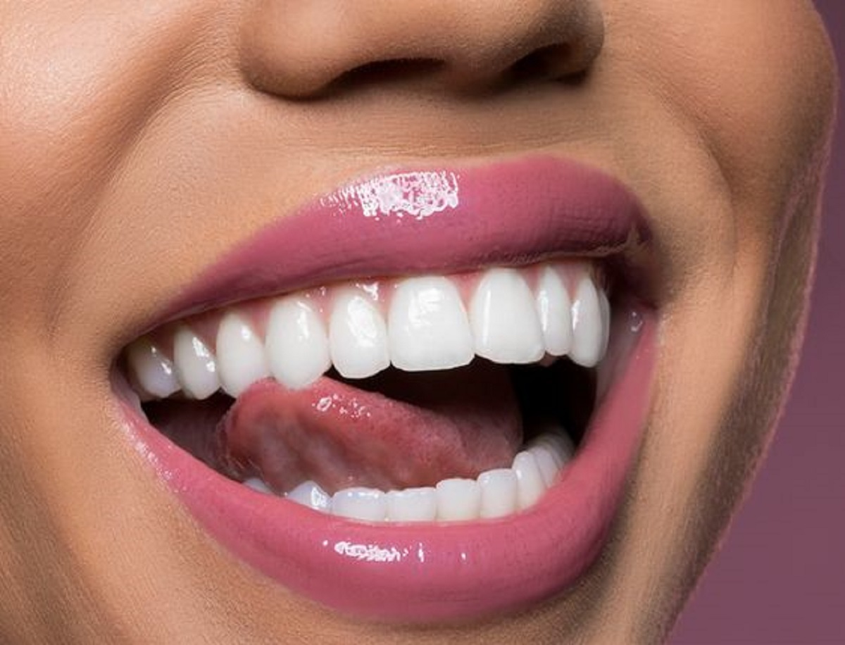 هوليود سمايل