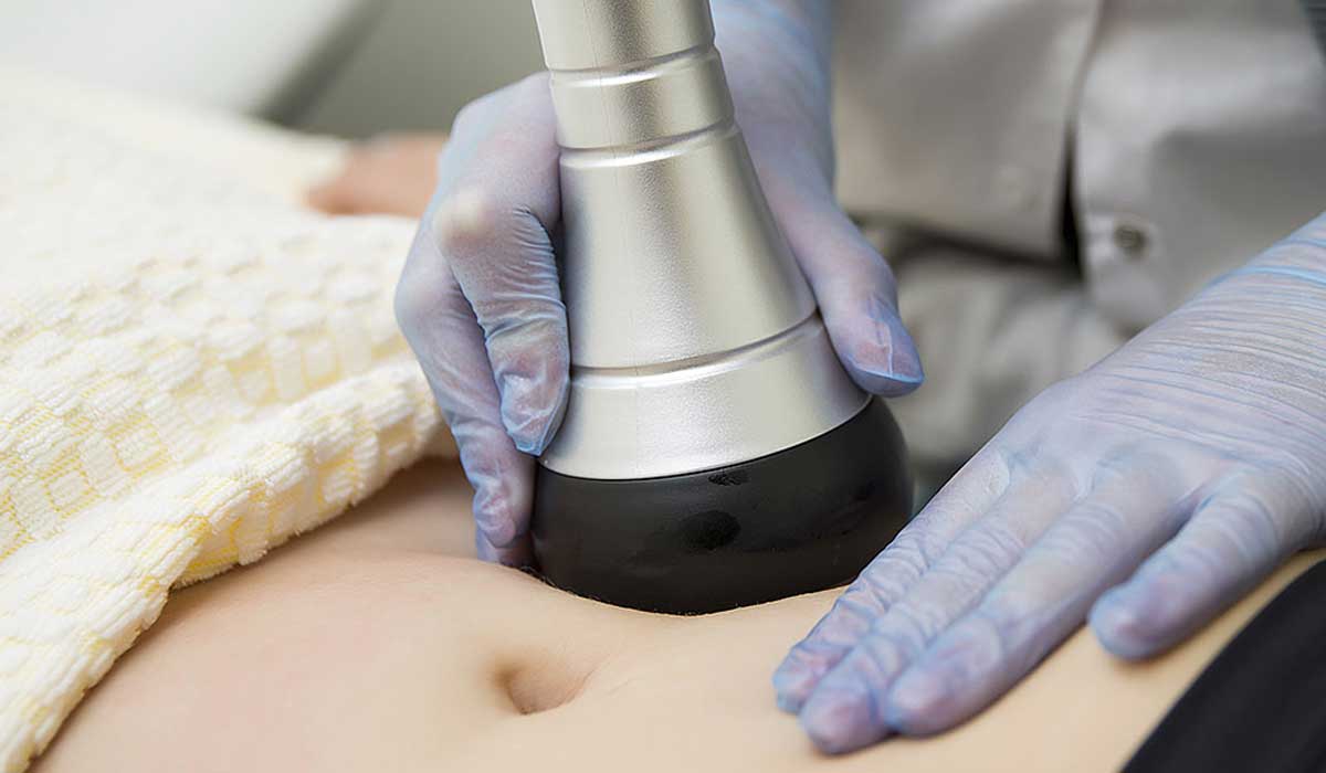  إزالة الكرش