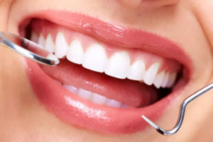 اسنان زيركون