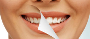 اسنان زيركون