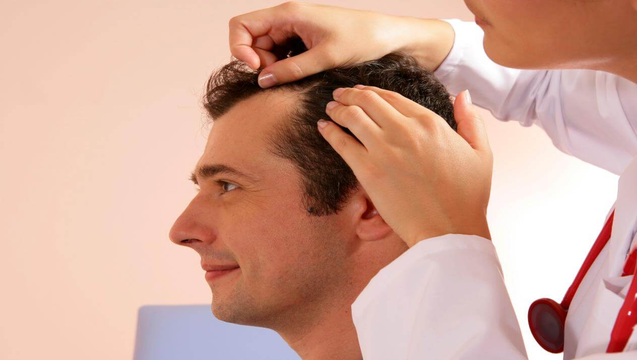 فوائد زراعة الشعر