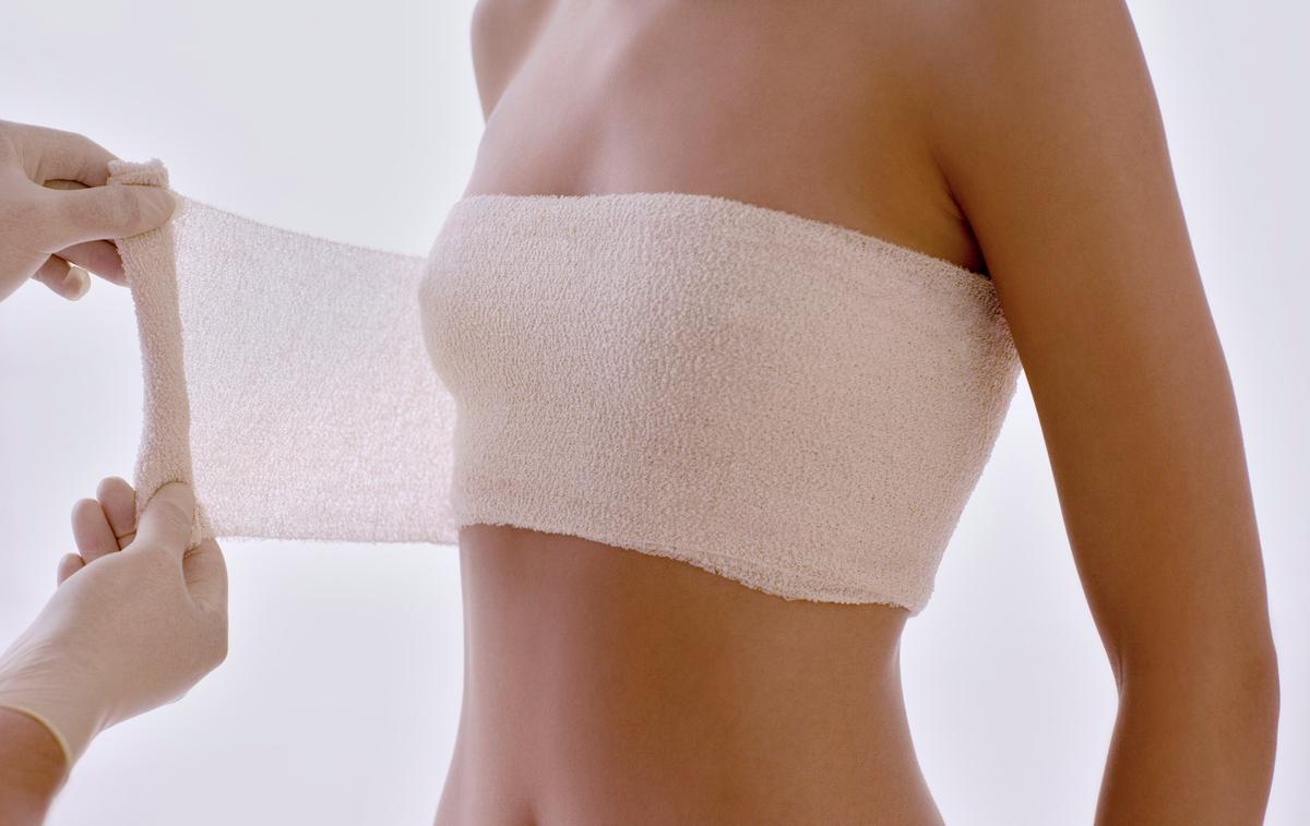 تجميل الثدي