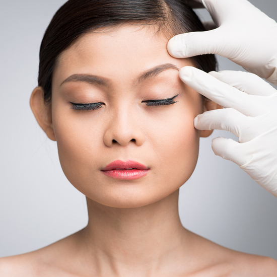 رفع الحواجب بالخيوط