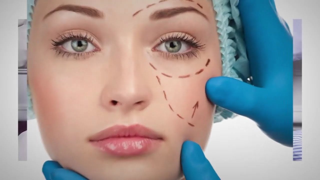 عملية تصغير الوجه