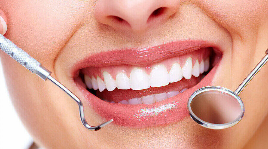 تبيض الاسنان في تركيا