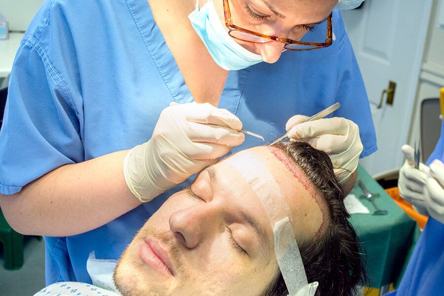 تقنيات زراعة الشعر في تركيا