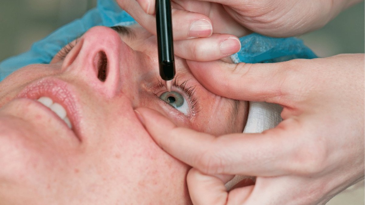 زراعة عدسة العين