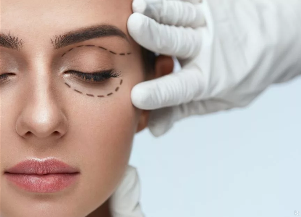 عملية تجميل العيون