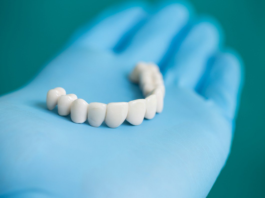 أسعار علاج الأسنان في تركيا