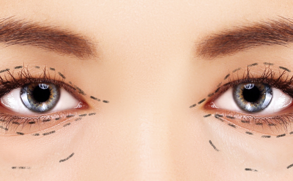 تكلفة عملية شد الجفون بالليزر