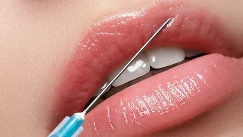 فيلر الشفايف في تركيا