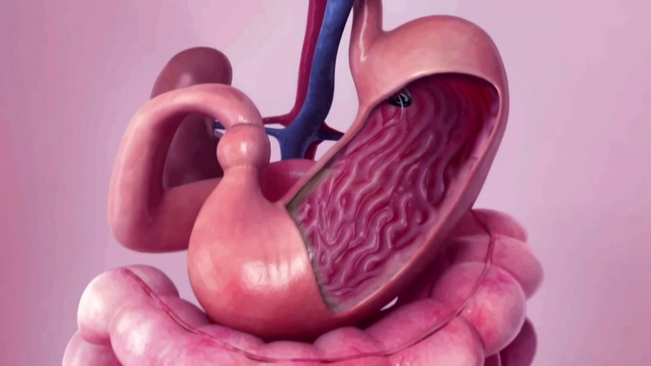 النصائح بعد عملية تكميم المعدة