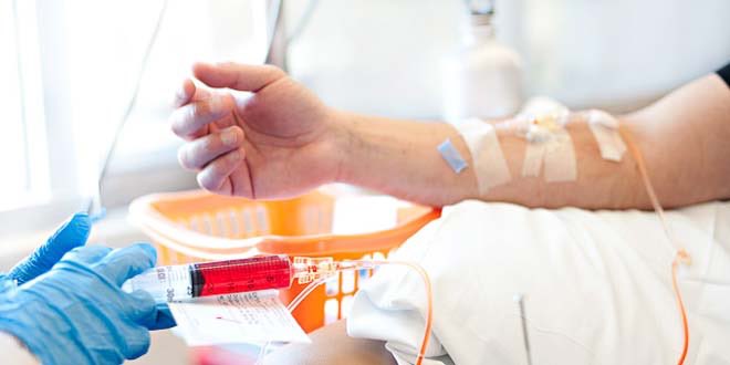 تكلفة العلاج الكيماوي في تركيا وأسبابه