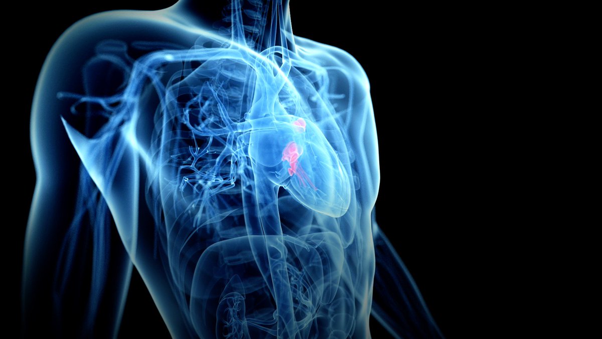 عمليات القسطرة في تركيا