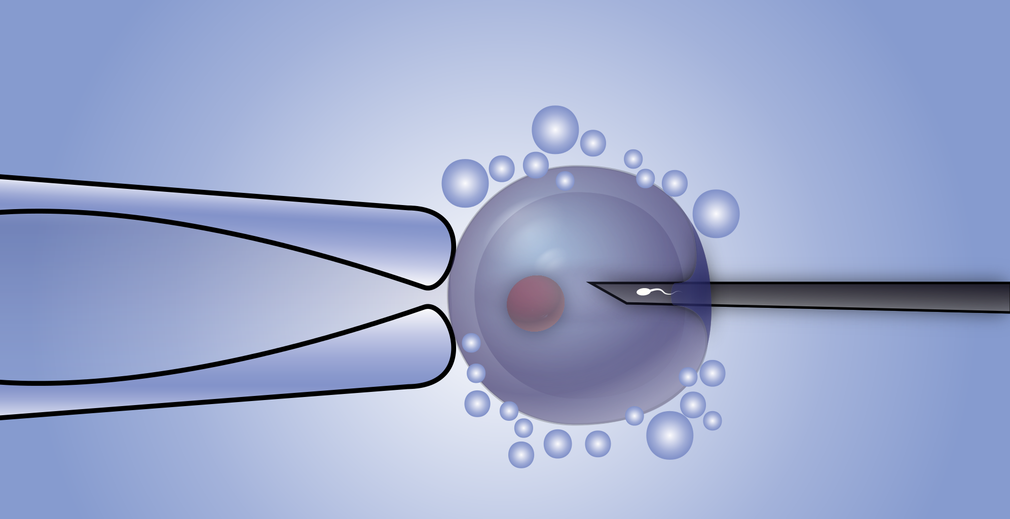  الحقن المجهري في تركيا