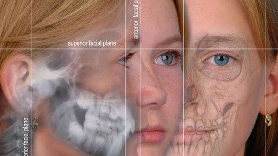 تكاليف جراحة الفك السفلي في تركيا