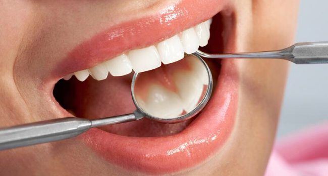 سعر تنظيف الأسنان