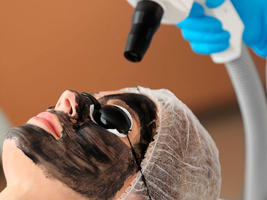 الليزر الكربوني في تركيا 