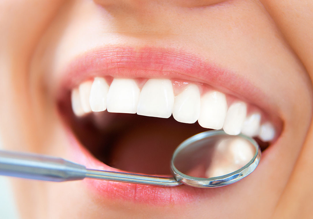 تركيب طقم الأسنان