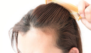 ما هو فيلر الشعر وما فوائده وآثاره الجانبية؟