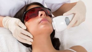 أفضل طريقة لإزالة الشعر بالليزر