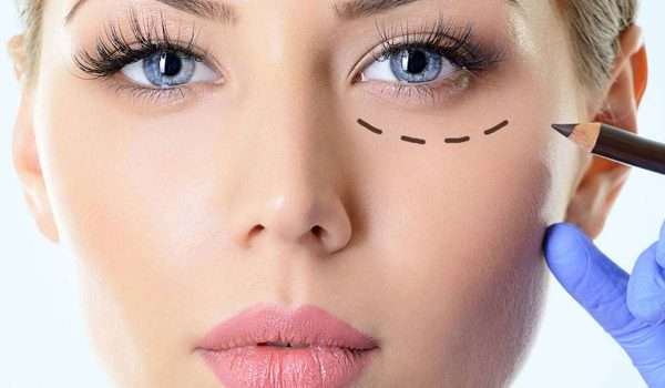 عمليات جراحة الجفن