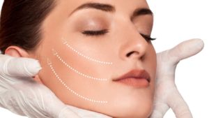 شفط دهون الوجه